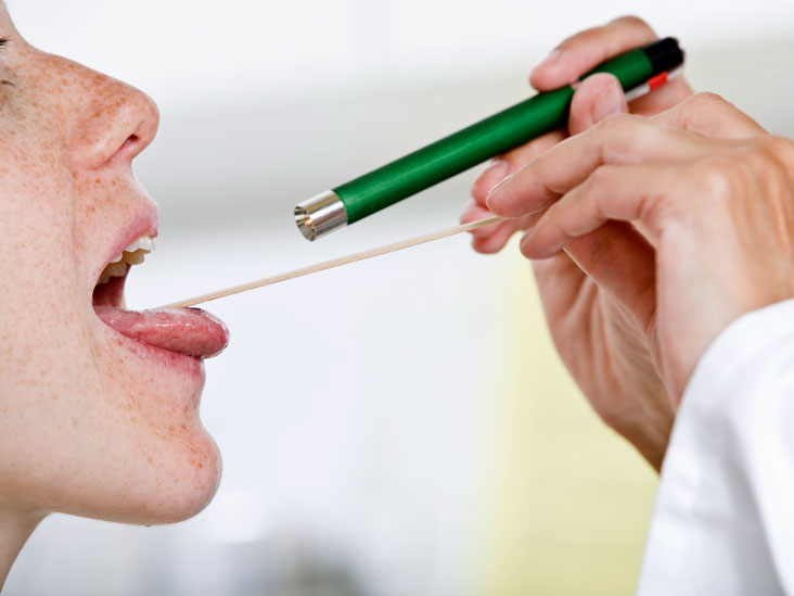 Remédios caseiros para garganta inflamada: Como Fazer